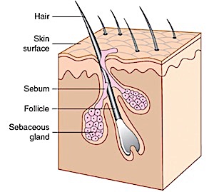 An up close look at a hair follicle and sebaceous gland. 